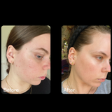 Imbibe Beauty Renewal